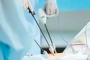 General surgery and laparoscopic procedures at SAI Hospital - minimally invasive surgical techniques