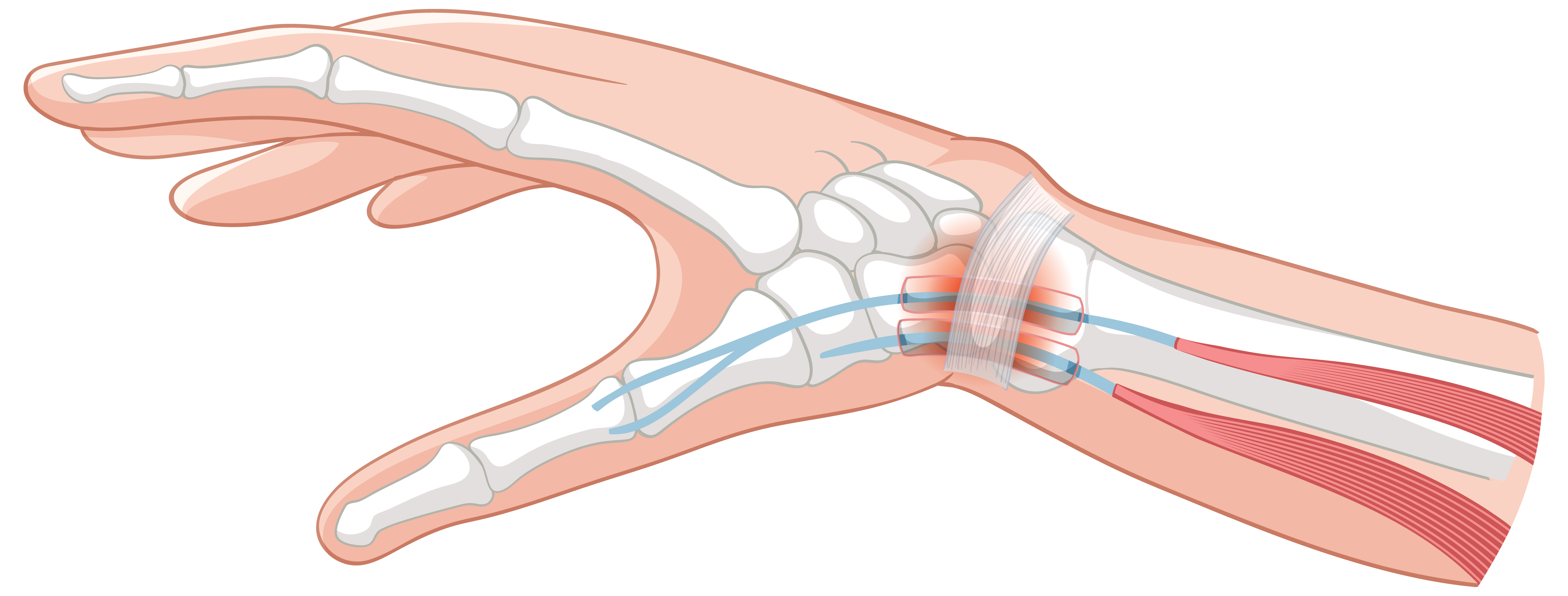 Orthopedics Department at SAI HOSPITAL